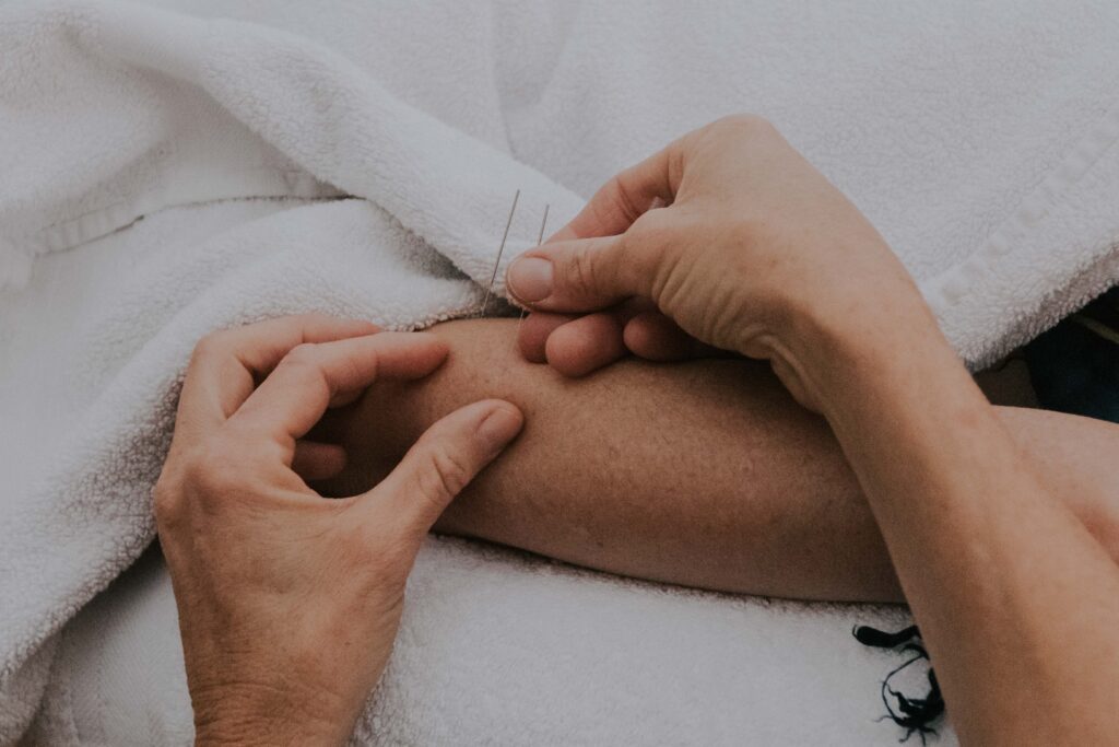 Acupuncture at the retreat for the soul